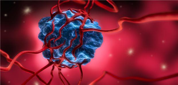 Krebszelle mit Blutgefäßen: Manche Krebszellen können sich der Chemotherapie entziehen, mehrere Monate oder sogar Jahre unentdeckt bleiben, bevor sie sich wieder zu vermehren beginnen und einen Tumorrückfall auslösen.