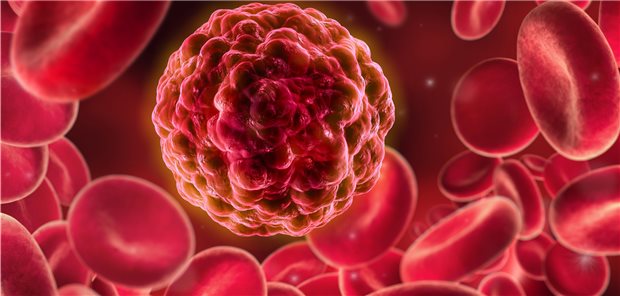 Krebszelle zwischen roten Blutkörperchen: Leukämien machten im Jahr 2018 unter allen neu diagnostizierten Krebserkrankungen einen Anteil von 2,3 Prozent bei den Frauen und 2,6 Prozent bei den Männern aus, zeigen Krebsdaten.