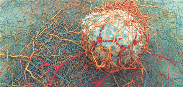 Abgebildet ist das 3D Bild einer Krebszelle.