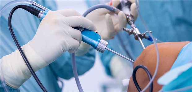 Kreuzbandersatz: Nach einem Riss des vorderen Kreuzbandes, der schon Monate zurückliegt, profitieren Patientinnen und Patienten einer randomisierten Studie zufolge stärker von einer Op als von einer Reha.
