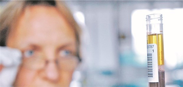 Hohes Krebsrisiko bei Thrombozytose Kritischer Blick auf die Blutprobe: Erhöhte Thrombozytenwerte sind ein Marker für ein erhöhtes Risiko für Tumorerkrankungen.