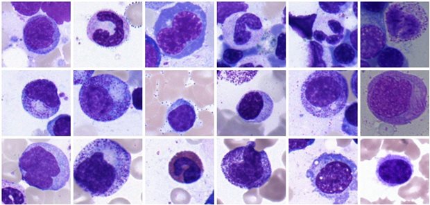 Künstliche Intelligenz erlaubt es, Knochenmarkzellen wie die hier abgebildeten automatisch zu klassifizieren.