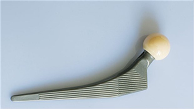 Chirurgen wollen Implantate in Zentren testen lassen Künstliches Hüftgelenk: Geht es nach der DGCH, sollten Implantate vor dem breiten Einsatz in Zentren evaluiert werden.