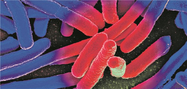 Antibiotika verändern Darmflora Kultivierte E. coli unter dem Elektronenmikroskop (kolorierte Aufnahme).