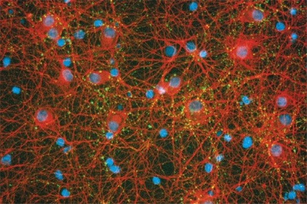ApoE4 erhöht nicht nur das Alzheimerrisiko Kultivierte Nervenzellen aus dem Kortex von Ratten. Mit solchen Systemen lassen sich in vitro therapeutische Substanzen gegen Alzheimer testen.