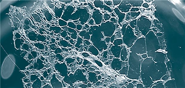 Kultivierter Lungenschnitt aus einer explantierten COPD-Lunge.