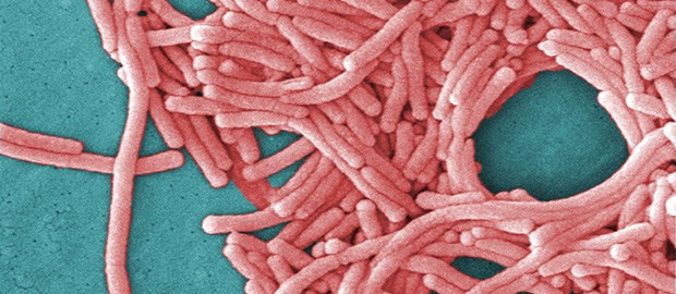 Schottland: Zwei Tote wegen Legionellen L. pneumophila: Ausgebrochen in Schottland.