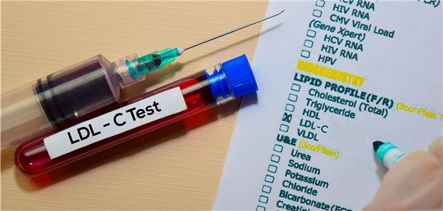 LDL-C-Test: Bei sehr hohem kardiovaskulärem Risiko gelten jetzt strengere Zielwerte.
