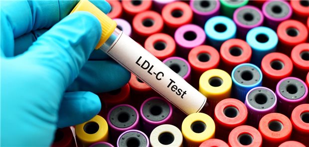 LDL-Cholesterin wird getestet: Menschen, die 5 mg bis 160 mg Pravastatin pro Tag einnahmen, senkten ihren Blut-LDL-C-Spiegel stark dosisabhängig um 18,3 Prozent bis 35,3 Prozent.
