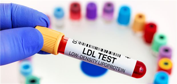 LDL-Kontrolle: Ist der Wert im Zielbereich? In Studien hat sich gezeigt, dass sich mit zwei subkutanen Inclisiran-Injektionen pro Jahr die LDL-Plasmaspiegel additiv zu anderen oralen lipidsenkenden Therapien um rund 50 Prozent senken lassen.