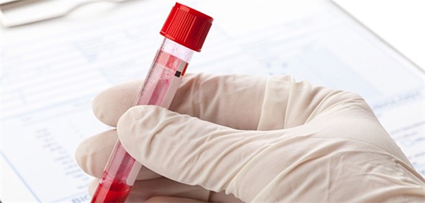 Labor-Ausnahmenummern sichern ordentliche Honorarbeträge.