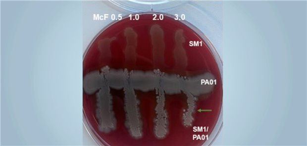Laborexperiment: Kurzkettige Fettsäuren hemmen (grüner Pfeil) das Wachstum von Bakterien in einer Kulturschale.
