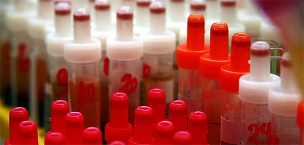 Laborleistung: Niedergelassene Ärzte haben offenbar im zweiten und dritten Quartal 2018 weniger beauftragt als im Vorjahresvergleich.