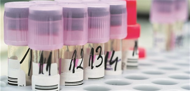 Laborproben: Analysen in Großlabors finden heute meist vollautomatisch statt.