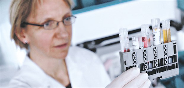 Labortest: Das PSA ist nicht tumorspezifisch genug, sondern steigt auch bei der BPH an.