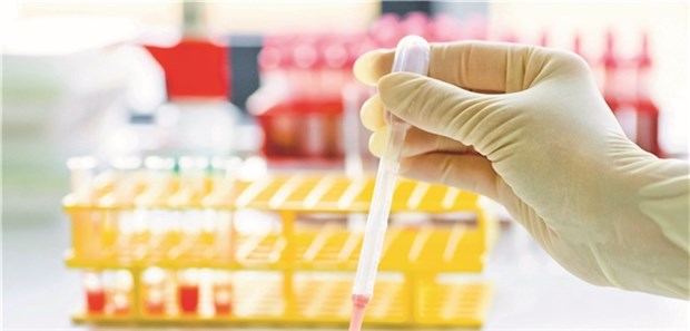 Labortest: Mutationen im FLT3-Gen betreffen viele Patienten mit einer akuten myeloischen Leukämie.