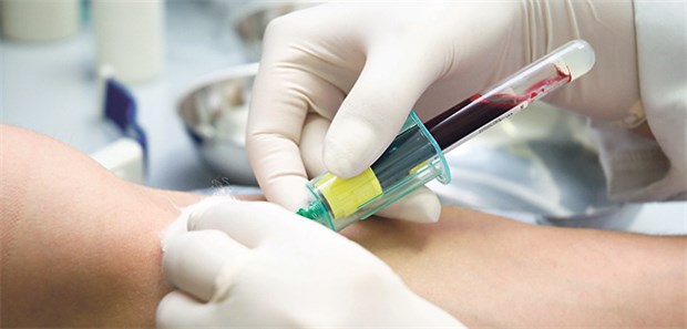 Lässt sich der TMAO-Spiegel im Blut durch mediterrane Ernährung senken?