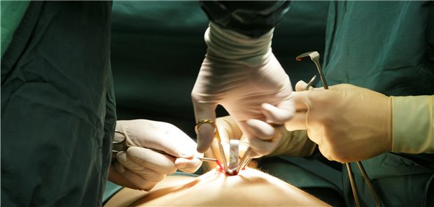 Chirurgen warnen vor neuem Klinik-Lockdown wegen Corona Laparoskopie eines Blinddarms: Die Akutversorgung der Patienten in der ersten Corona-Welle hat funktioniert, so das Fazit der Chirurgen. Doch wird das in der zweiten Welle genauso sein?