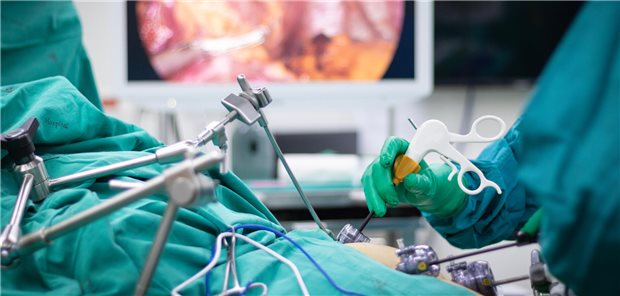 Laparoskopische Schlauchmagen-Op: Bariatrische Operationen können verhindern, dass Typ-2-Diabetes entsteht. Darauf lassen Ergebnisse einer beim ASMBS-Kongress veröffentlichten Studie schließen.