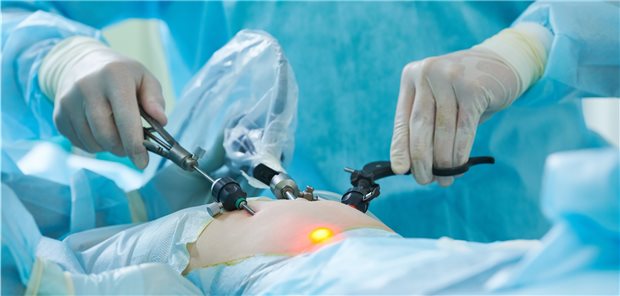 Laparoskopischer Eingriff zur Entfernung der Gallenblase.