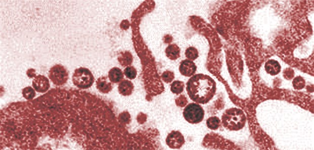 Ansteckung wohl über Leiche Lassa-Virus: Erstmals ist es außerhalb der Endemiegebiete zu einer Mensch-zu-Mensch-Übertragung gekommen.