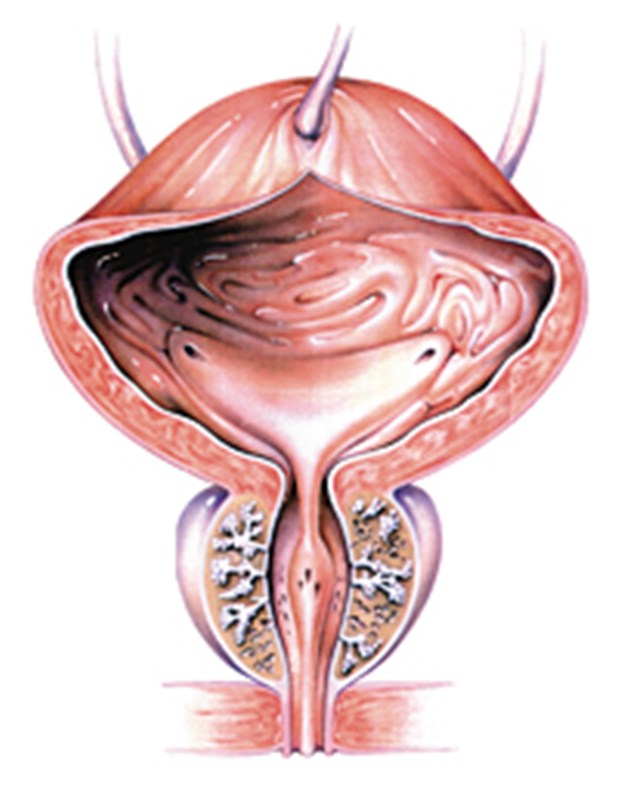 Metabolisches Syndrom erhöht BPH-Risiko Lassen IGF-1 und Östradiol bei Patienten mit metabolischem Syndrom die Prostata wachsen?