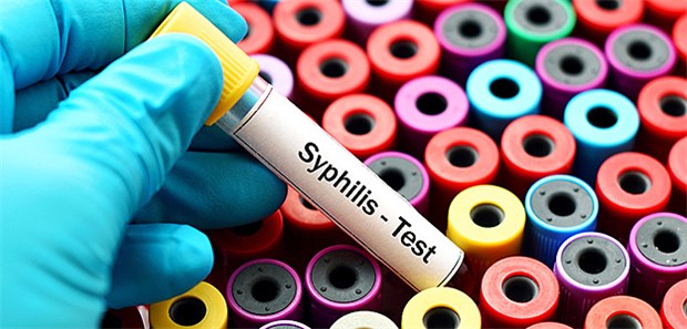 Immer mehr Syphilis-Infizierte in Europa Laut ECDC sind rund 90 Prozent der Syphilis-Infizierten sind Männer. Die meisten Infektionen gibt es bei den 25- bis 34-Jährigen.