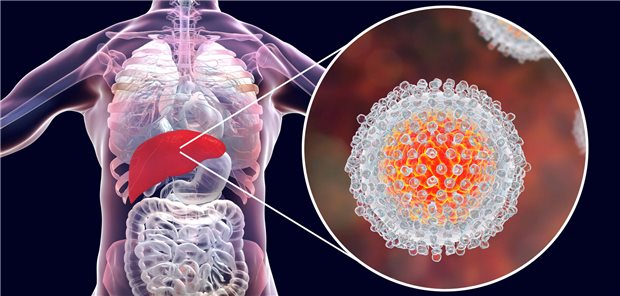 Laut Studien könnte die virale Replikation des Hepatitis-C-Virus im extrahepatischen Gewebe eine ausgeprägte Immunaktivierung mit systemischer Wirkung fördern und so zu Komplikationen auch außerhalb der Leber führen.