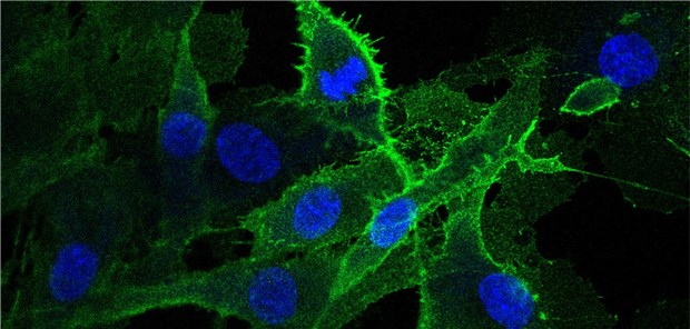 Lavins Muskelzellpopulation zeigt eine starke Expression des Oberflächenproteins CLEC14A (grün). 