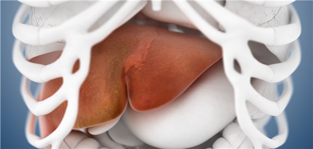 Neuer Ansatz gegen Leberkrebs? Leber im Fokus: Lässt sich durch neue molekulare Erkenntnisse in die Prozesse einer Fibrosierung eingreifen?