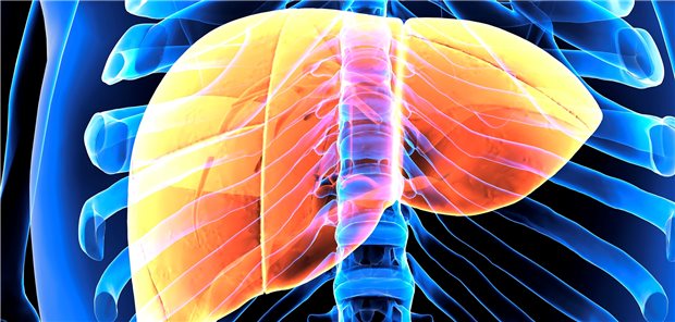 Symbolbild: Grafik einer Fettleber