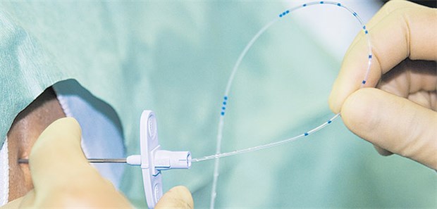 Keimbefall nach Infiltration trifft 28 Patienten Lege artis: Epidurale Injektionen kommen im Rahmen der Schmerztherapie zum Einsatz.