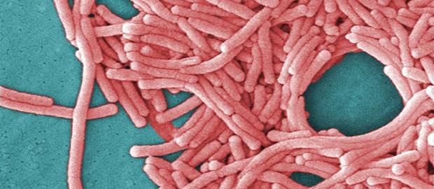 Legionellen stören Eiweißproduktion Legionellen mit Loch: Blockade der Proteinbiosynthese.