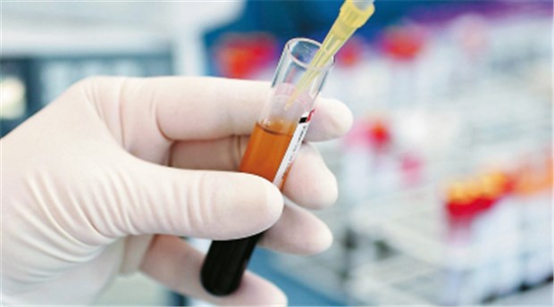 Exzesse bei Privatlaborleistungen? Leistungen aus der Laborgemeinschaft stellen für Praxen ein heikles Leistungsgebiet dar. © Franz Pfluegl / Fotolia.com