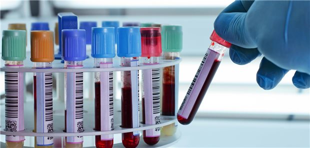 Delegation im Labor: So minimieren Praxen die Abrechnungsrisiken Röhrchen mit Blut im Labor.