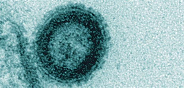 Neuer Ansatz für Krebs-Impfstoffe Lentiviraler Proteintransfervektor (elektronenmikroskopische Aufnahme).