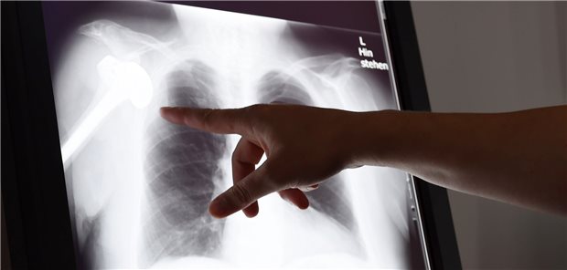 Rheuma-Liga: Hier muss das Patientenrechtegesetz nachgebessert werden Liegt der Verdacht auf einen Behandlungsfehler vor? Unter anderem die Schlichtungsstellen beschäftigt solche Fragen.