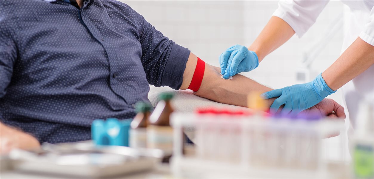 Kann Man Parkinson Im Blut Feststellen www.aerztezeitung.de