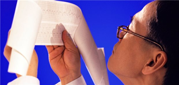 Liegt ein Vorhofflimmern vor?  Beim Auftreten von Rhythmusstörungen raten US-Kardiologen, immer auch an Medikamente als Auslöser zu denken.