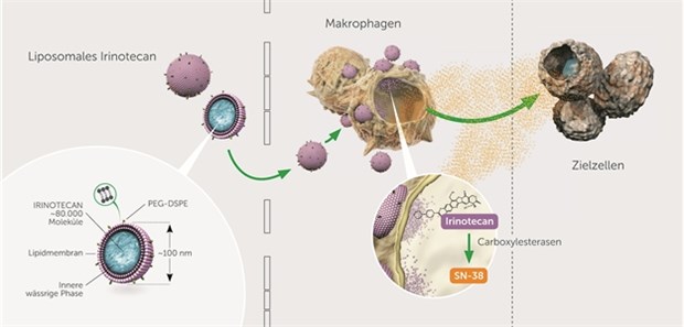 Liposomales Irinotecan wird in Tumor-assoziierten Makrophagen in den aktiven Metaboliten SN-38 umgewandelt. sN-38 wird im Tumorgewebe freigesetzt und von den Tumorzellen aufgenommen, und das Tumorwachstum wird gebremst.