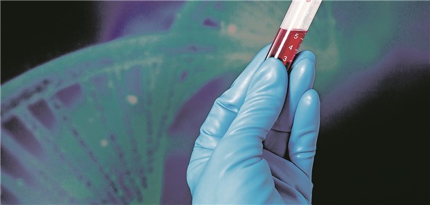 Liquid Biopsy: In der Studie ließen sich Resistenz auslösende Veränderungen nachweisen, die bei der Biopsie unentdeckt blieben.