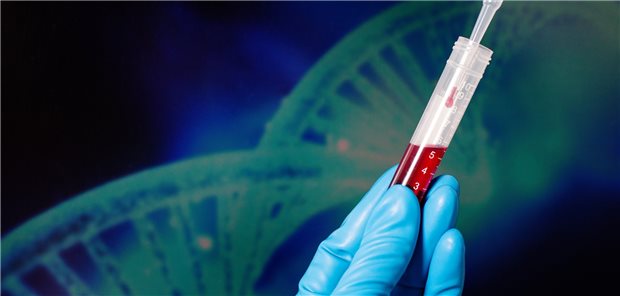 Chancen und Hürden der Präzisionsonkologie Liquid Biopsy: Nur einer von vielen Ansätzen, um die Versorgung Krebskranker weiter zu optimieren.