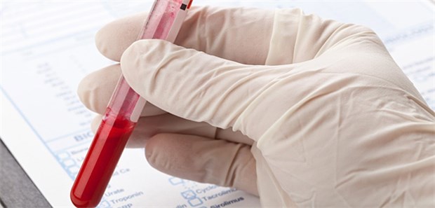 Liquid Biopsy umfasst derzeit etwa 50 verschiedene Testmethoden. Eine Standardisierung ist wichtig.