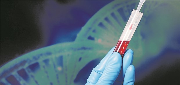Liquid biopsy: In der CCGA-Studie wurden drei molekularbiologische Verfahren untersucht.
