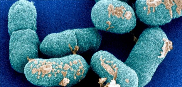 Listeria monocytogenes: auf – genetisch veränderten – Bakterien dieser Spezies beruht der neue Impfstoff gegen primären Leberkrebs.