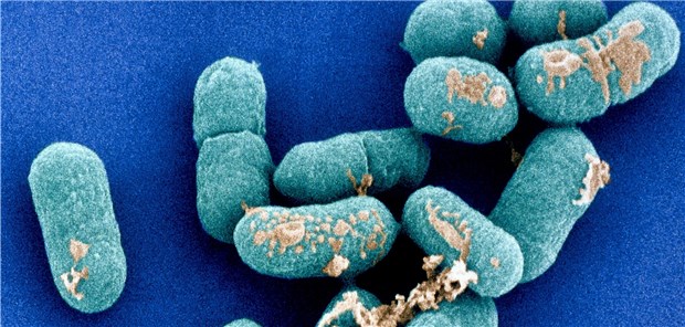 RKI meldet dritten Listerien-Todesfall Listeria monocytogenes kann bei Immungeschwächten invasive Listeriosen mit Sepsis, Meningitis oder Enzephalitis auslösen.