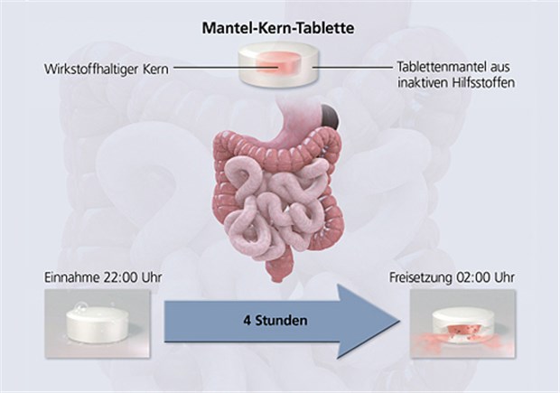 Lodotra® setzt durch die Spezialgalenik der Mantel-Kern-Tablette sein Prednison vier Stunden verzögert frei, dann mit der vollen Wirkstoffdosis.