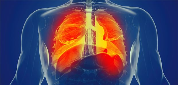 Lunge in Gefahr: Die neue NationaleVersorgungsleitlinie COPD vermittelt die angemessene Therapie.