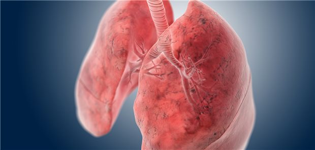 Lunge in Not: Fast sieben Prozent der Bundesbürger waren 2021 an einer COPD erkrankt.