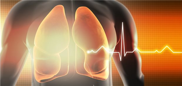 Lunge und EKG – wer eine ambulant erworbene Pneumonie hat (CAP), hat ein höheres Risiko für kardiovaskuläre Ereignisse. Einer Studie zufolge ist dieses Risiko geringer bei Patienten, die vorher ASS bekommen haben.